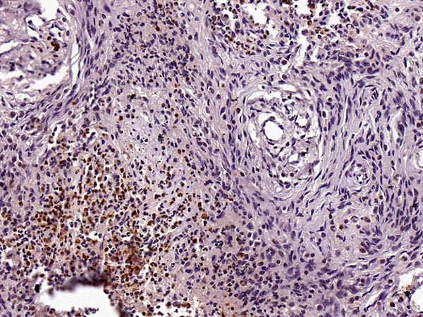 胶质纤维酸性蛋白(Glial Fibrillary Acidic Protein,GFAP)抗体试剂(免疫组织化学) 胶质纤维酸性蛋白(Glial Fibrillary Acidic Protein,GFAP)抗体试剂(免疫组织化学)