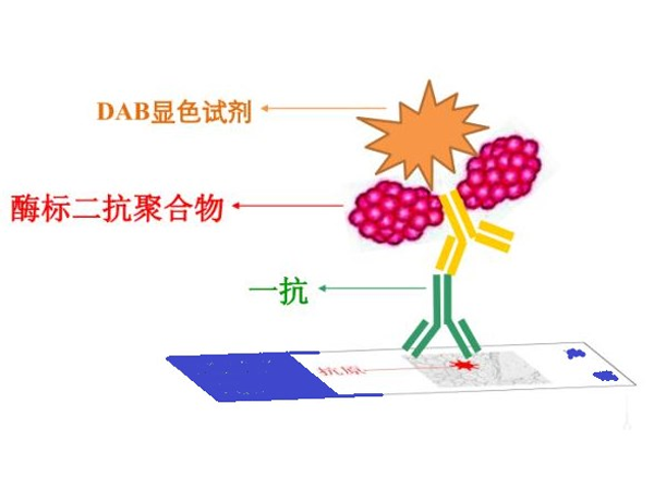 关于免疫组化